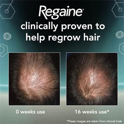 Regaine Shkume per Burra me 5% Minoxidil 3x60g